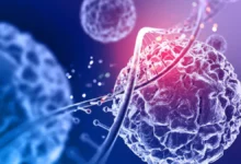 Photo of महिलाओं से ज्यादा पुरुष हो रहे हैं कैंसर का शिकार