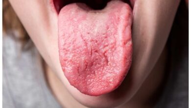 Photo of जीभ पर दिखते हैं विटामिन-B12 की कमी के 3 बड़े संकेत