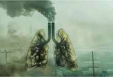 Photo of जहरीली हवा से बढ़ रहा फेफड़ों की इस गंभीर बीमारी का खतरा