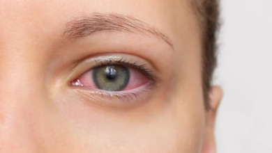 Photo of जिसे साधारण एलर्जी समझ रहे हैं, कहीं वो अर्बन आई सिंड्रोम तो नहीं?